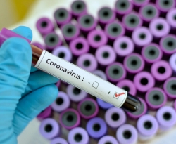 Com 987 casos confirmados, Roraima é o único estado que não tem registro do coronavírus 