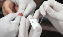 Agevisa proíbe testes rápidos para detecção do coronavírus em farmácias e drogarias na PB
