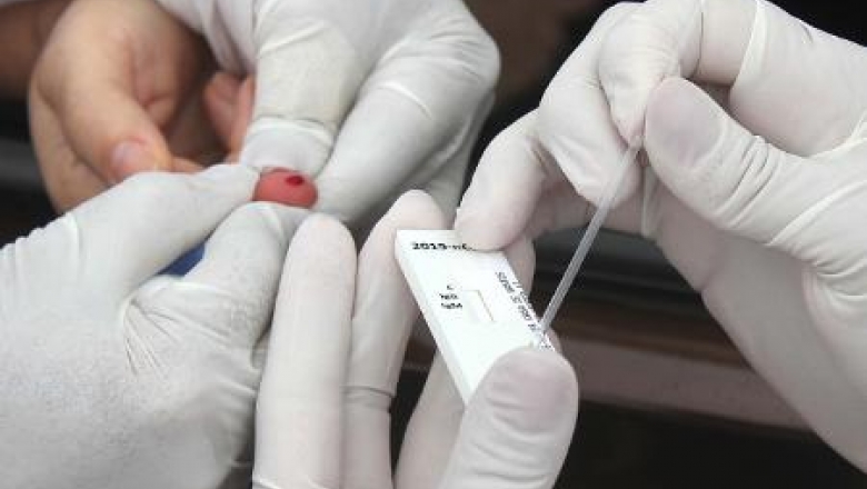 Agevisa proíbe testes rápidos para detecção do coronavírus em farmácias e drogarias na PB