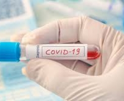 Brasil tem mais de 100 mil casos confirmados de COVID-19, com sete mil mortes