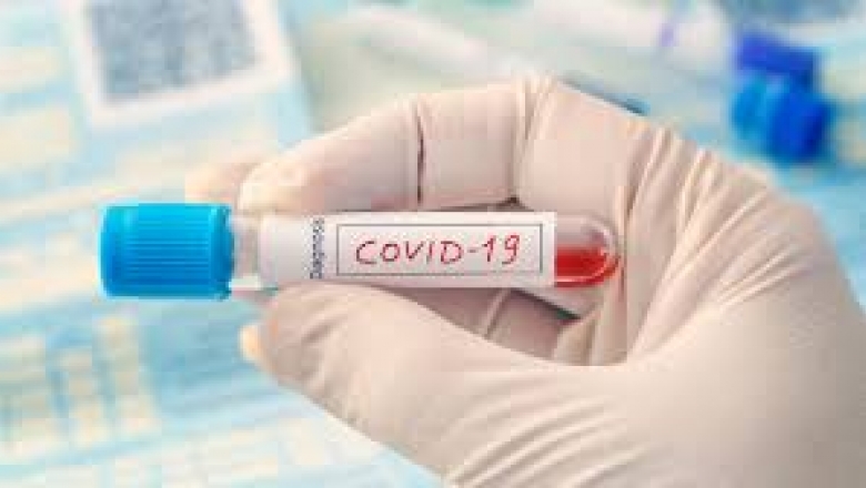 Brasil tem mais de 100 mil casos confirmados de COVID-19, com sete mil mortes