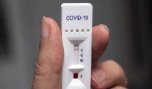 Teste detecta anticorpos contra o coronavírus invisíveis até hoje