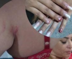 Polícia investiga possível agressão de sanfoneiro contra ex-mulher no CE
