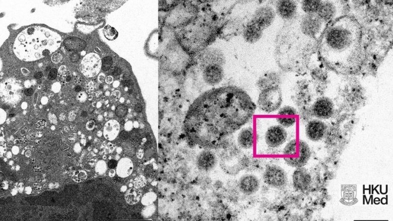 Covid-19: cientistas revelam novos sintomas da Ômicron