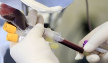 Varíola dos macacos: Anvisa faz recomendações sobre doação de sangue