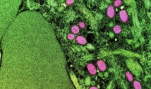 Vírus da varíola do macaco é encontrado na saliva e no sêmen dos infectados  