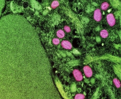 Vírus da varíola do macaco é encontrado na saliva e no sêmen dos infectados  