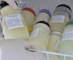 Cientistas usam leite humano para tratar Covid prolongada em paciente com imunodeficiência grave