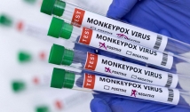 Casos de varíola dos macacos chegam a 76 em todo o país, sendo 2 no Ceará