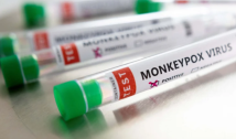 Sobe para sete o número de infectados com varíola dos macacos na PB; 47 notificações ainda estão em investigação
