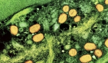 Estudo: varíola dos macacos tem efeitos trágicos em imunossuprimidos