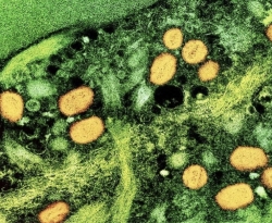 Estudo: varíola dos macacos tem efeitos trágicos em imunossuprimidos
