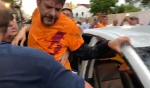 Senador Cid Gomes é baleado durante protesto no Ceará