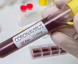 Casos de coronavírus sobem para 110 e mortes para 13 na PB