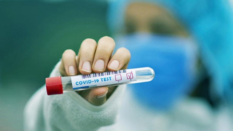Serra Grande registra primeiro caso de coronavírus; homem tem 29 anos e já está em isolamento