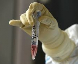 Governo da PB abre chamada pública para aquisição de testes sorológicos para detecção da Covid-19