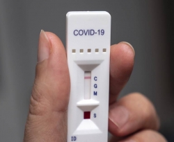 Teste detecta anticorpos contra o coronavírus invisíveis até hoje