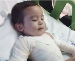 Criança que sofreu queimaduras com óleo quente no Sertão da PB, se recupera bem em hospital de Fortaleza