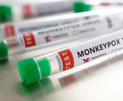 Sobe para sete o número de infectados com varíola dos macacos na PB; 47 notificações ainda estão em investigação