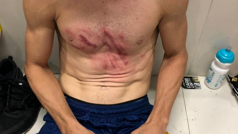 Diretoria do Atlético questiona gol anulado e divulga foto que mostra marcas de agressão em jogador